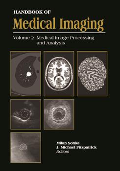 Handbook of Medical Imaging, Volume 2. Medical Image Processing and Analysis
