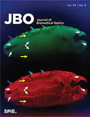 Thumbnail for Journal of Biomedical Optics